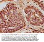 SOD1 Antibody