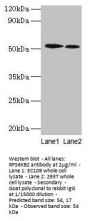 RPS6KB2 Antibody