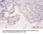 RPS6KB2 Antibody