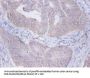 PRKCSH Antibody
