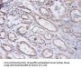 PRKCSH Antibody