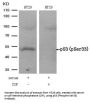 Phospho-TP53 (Ser33) Antibody