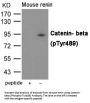 Phospho-CTNNB1 (Tyr489) Antibody