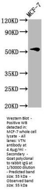 VTN Antibody