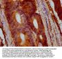 VTN Antibody