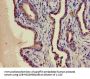 PIM1 Antibody