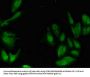 PIM1 Antibody