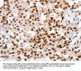 MUTYH Antibody
