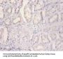 NDUFA2 Antibody