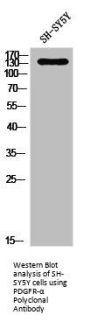 PDGFRA Antibody
