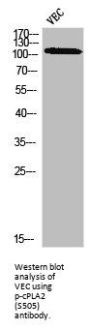 Phospho-PLA2G4A (S505) Antibody