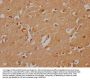 PLCB2 Antibody