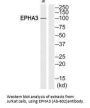 EPHA3 (Ab-602) Antibody