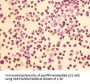 HOMER1 Antibody
