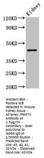 PRMT1 Antibody