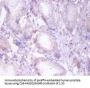 HADHB Antibody