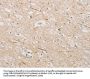 ZWINT Antibody