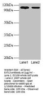 EXTL3 Antibody