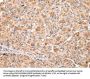 RERE Antibody