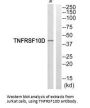 TNFRSF10D Antibody