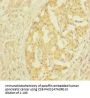 CLTB Antibody