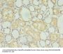 TBCB Antibody