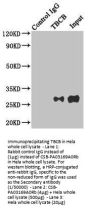 TBCB Antibody