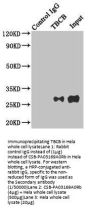 TBCB Antibody