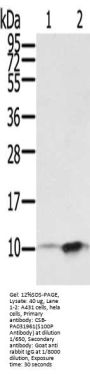 S100P Antibody
