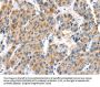UCP2 Antibody