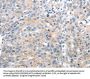 UCP2 Antibody