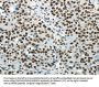 HNRNPM Antibody
