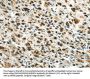HNRNPM Antibody