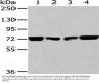 HNRNPM Antibody