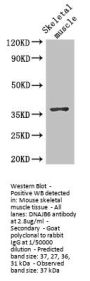 DNAJB6 Antibody