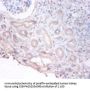 PHGDH Antibody