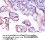 PHGDH Antibody