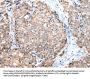 DUSP11 Antibody