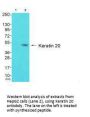 KRT20 Antibody