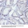 SYNCRIP Antibody
