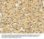 Rabbit anti-human LEP polyclonal antibody