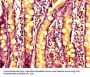 ARPC2 Antibody