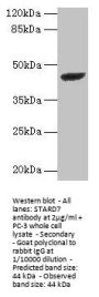 STARD7 Antibody