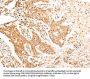 Rabbit anti-human ALDH3A2 polyclonal antibody