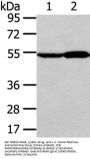 Rabbit anti-human ALDH3A2 polyclonal antibody