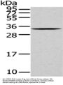 HNRNPC Antibody