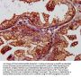 BCAP31 Antibody