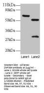 ZNF384 Antibody