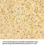 ZNF384 Antibody