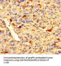 ZNF384 Antibody